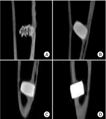 Fig.  7.  Comparison  of  the  CT  findings  among  the  4  groups  (A: 
