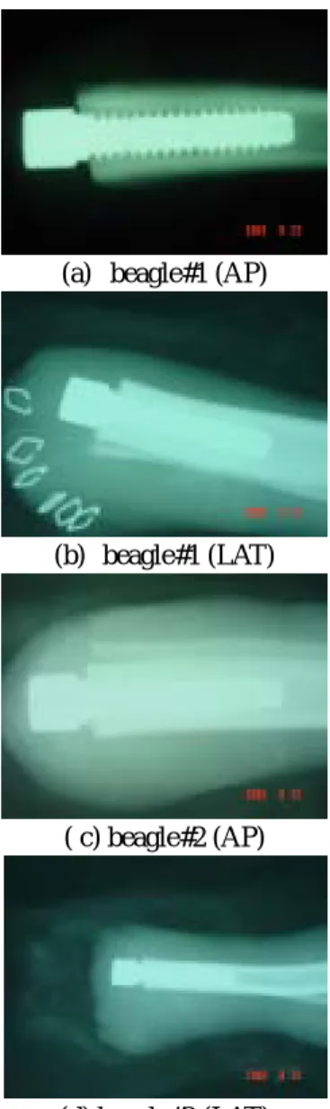 Table 3 Applied implant size  4.  결  론   Modeling  Operation  Beagle#1  ∅6.6  ∅6.4  Beagle#2  ∅6.6  ∅6.2  본  연구에서는  골융합  임플란트를  개발하기  위 한  첫번째  단계로  임플란트의  형상을  설계하였고 동물  임상  실험으로  비글견의  경골에  임플란트  삽 입  수술을  수행하여  생체에  골융합  임플란트의  적 용  가능성을  연구하였다