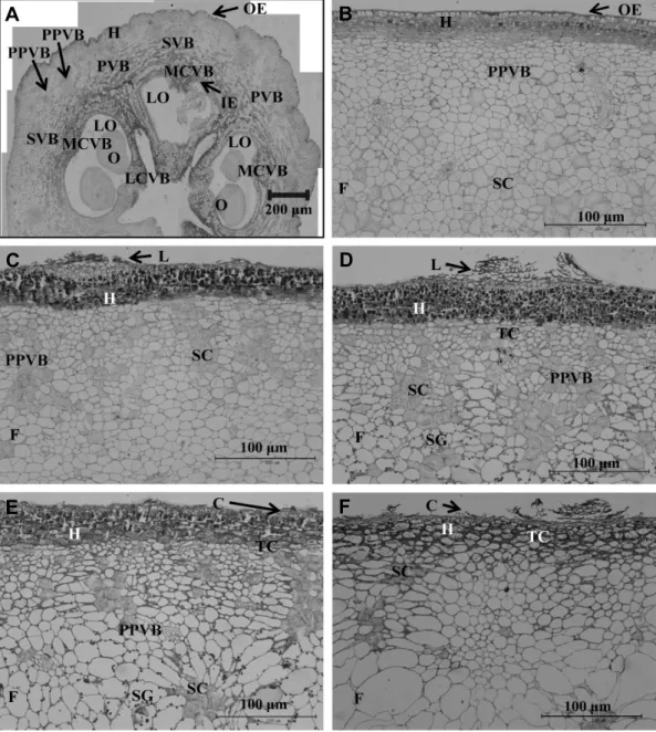 Fig.  1.  Cross  section  of  ‘Hanareum’  pear  fruits  at  full  bloom  (A)  and  20  (B),  40  (C),  60  (D ),  70  (E),  114  (F)  days  after  full  bloom  (×400)