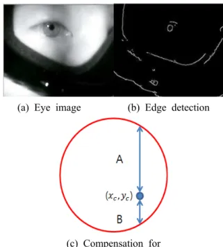 Fig. 7 Process for extracting eyeball area