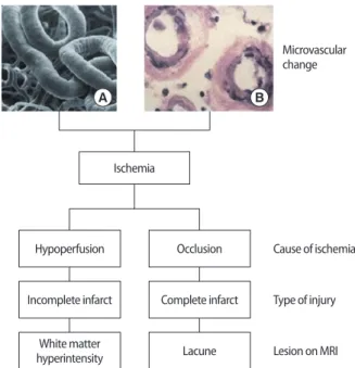 Fig. 1. (A) Blood supply of cerebral white matter (WM) by (a) medullary  artery (b) lenticulostriate artery and (c) choroidal artery