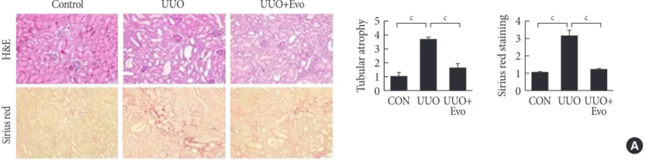 Fig. 1. Effects of evogliptin (Evo) on renal fibrosis and pro-fibrotic gene expression in kidneys of unilateral ureteral obstruction  (UUO) mice
