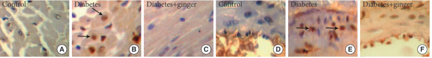 Fig. 2. (A-C) Masson trichrome staining showing fibrosis bonds in the heart tissue of diabetic rats compared to the control group