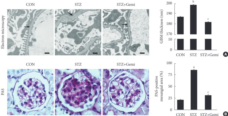 Fig. 2. Effect of gemigliptin (Gemi) on glomerular basement membrane (GBM) thickening