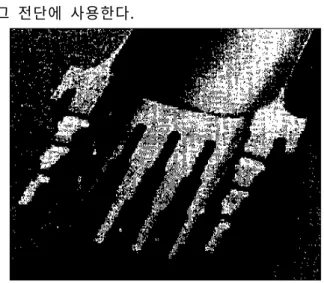 Fig. 5 Vane type