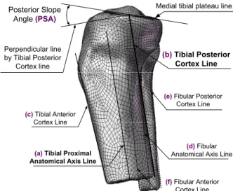 Fig. 8 Definition of anteromedial cortex oblique angle (ACOA()) on horizontal plane of osteotomy site