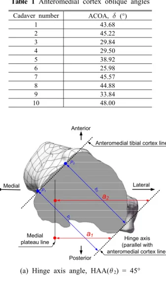 Table 1 Anteromedial cortex oblique angles Cadaver number ACOA,  (°)