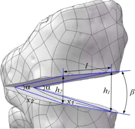 Fig. 16 Measurement of wedge angle after high tibial osteotomy