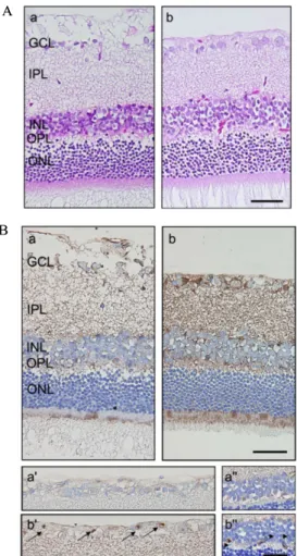 Fig.  1.  Expression  of  VEGF  in  the  retina  and  the  expression  of  VEGF  in  the  serum  of  STZ-induced  diabetic  rats