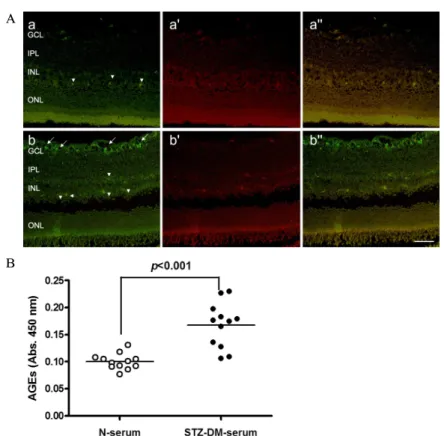 Fig.  2.  Localization  of  AGEs  and  RAGE  in  the  retina  and  expression  of  AGEs  in  the  serum  of  STZ-induced  diabetic  rats