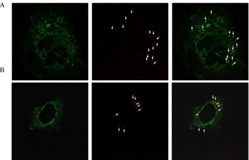 Fig.  4.  Comparison  of  PEI-LP  with  PEI  in  cell  free  assay.  Mitochondria  were  isolated  from  A7R5  cells