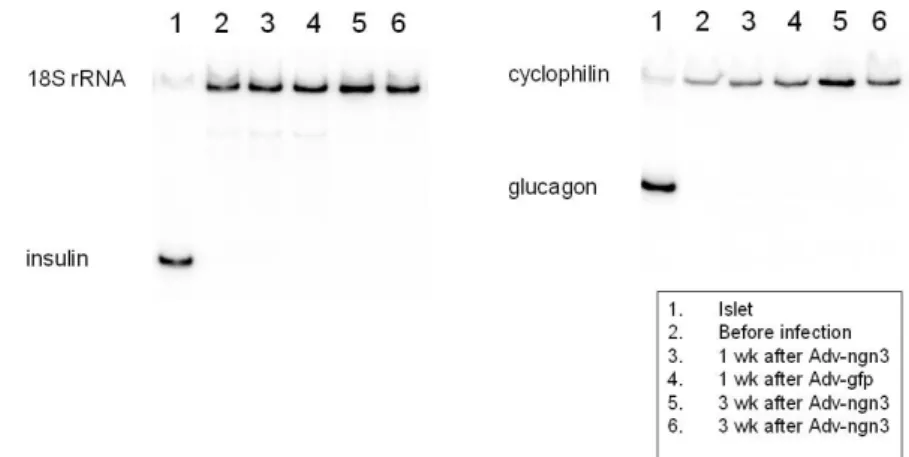 Fig. 6. RT-PCR of insulin mRNA from pancreatic duct cells 3 days after treatment of forskolin (FK), exendin-4 (Ex4) or cholera toxin (CT).