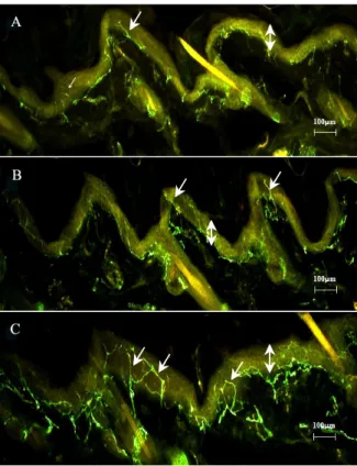 Fig.  3.   The  level  of  insulin  secretion  in  the  isolated  beta  cell  in  response  to  20  mM  glucose  medium