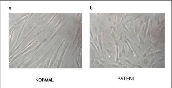 Fig. 3. Stimulation of glucose uptake by insulin in normal controls and patients fibroblasts