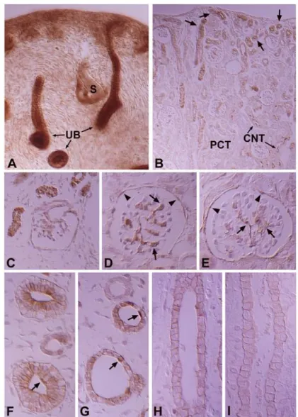 Fig. 2. DIC micrographs of wax sections illustrating immunostaining for PKC in 16- (A), 18- (C &amp; F), and 20-day-old (G) fetal kidneys, α and 3- (D &amp; H) and 7-day-old (B, E &amp; I) pups