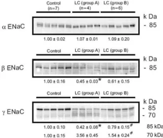 Fig. 4. Semi-quantitative immunoblots of kidney protein  prepared  from  cortex/OSOM  of  control  and  CCl 4 -  treated  cirrhosis  rats  subdivided  into  group  A  or  group  B  liver  cirrhosis  in  protocol  1