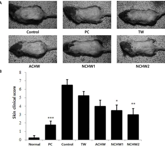 Fig.  2.  Effect  of  natural  carbonated  hot  spring  water  on  the  development  of  AD-like  dorsal  skin  lesions  in  DNCB-treated  NC/Nga  mice