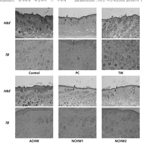 Fig.  3.  Effect  of  natural  carbonated  hot  spring  water  on  the  histological  features  of  AD-like  dorsal skin lesions in DNCB-treated NC/Nga mice