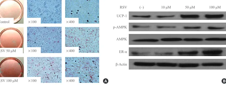 Fig. 1. Effects of resveratrol (RSV) on the differentiation of brown adipocytes. (A) Oil-red-O staining of primary cultured brown preadi- preadi-pocytes