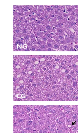 Fig. 1. Effects of SMe on Total Cholesterol  and  Triglyceride  Levels  in  Hyperlipidemic  mice