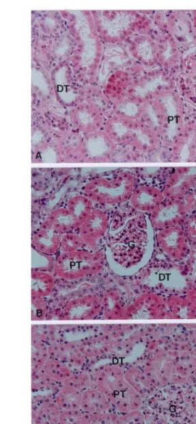 Fig.  10.  Effect  of  PJS  treatment  on  changes  in  renal  cortical  lipid  peroxidation  in  glycerol-induced  acute  renal  failure