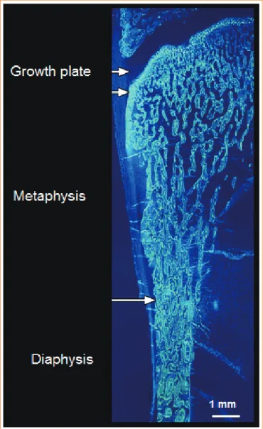Fig. 3. Formation of the cortical bone of the metaphyseal region, a  common site of fracture, occurs by corticalisation of trabeculae  emerging from the growth plate (see text)