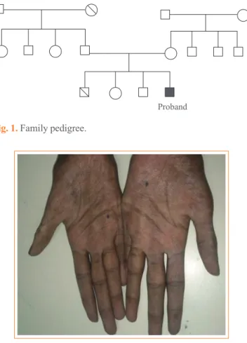 Fig. 1. Family pedigree.