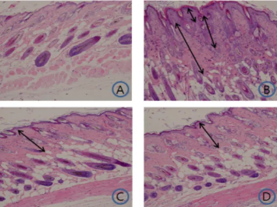 Fig. 14. Effects of CYT and CYTBH on the  level  of  IgE  in  the  serum  of  TNCB-induced  atopic dermatitis model of NC/Nga mice