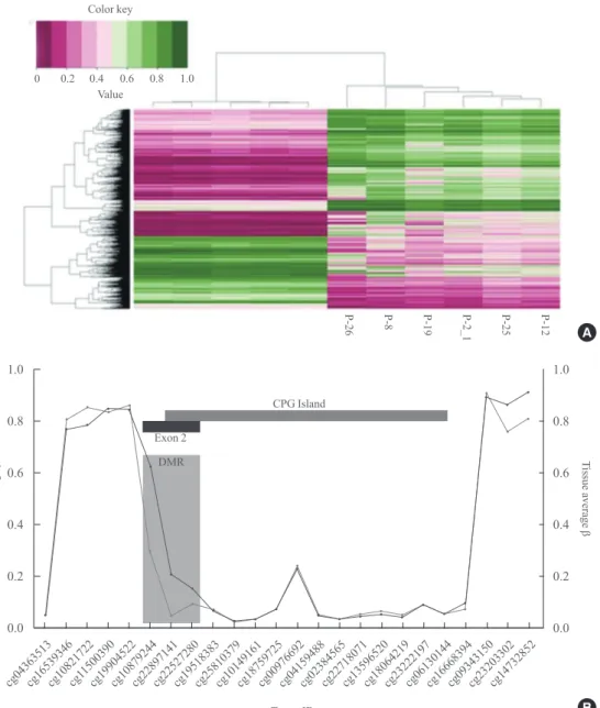 Fig. 4. Distinct methylation pattern of hereditary parathyroid tumors compared to respective blood controls (A) and methylation profile  of the MENIN gene (B)