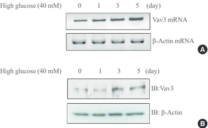 Fig. 2. (A) Total RNA was cultured under high glucose culture conditions in the presence or absence of 5-aminoimidazole-4-carboxy- 5-aminoimidazole-4-carboxy-amide-1-d-ribofuranoside (AICAR) treatment, and reverse transcription-polymerase chain reaction (R