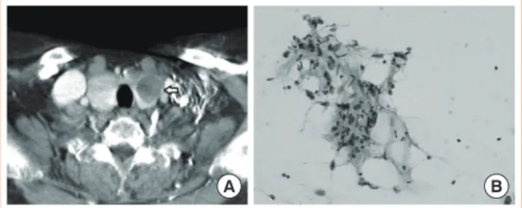Fig. 1. Chest computed tomography (CT) at initial diagnosis and  final pathology after initial surgery