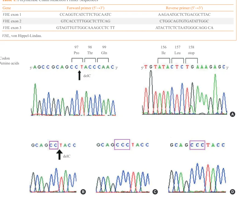 Fig. 2. The VHL gene mutation of the patient and her family members. (A) Sequencing analysis reveals a 291C deletion mutation, which  produces a frameshift and an early stop codon