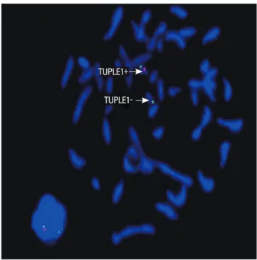 Fig. 2. Result of fluorescence in situ hybridization analysis during metaphase. 