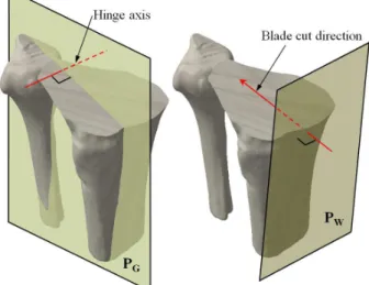 Fig. 4 Definition of two planes to estimate gap angle and  wedge angle 