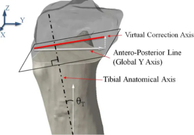Fig.  7  Three  points  p O ,  p M ,  p A  to  define  a  tibial  cut  plane P CUT