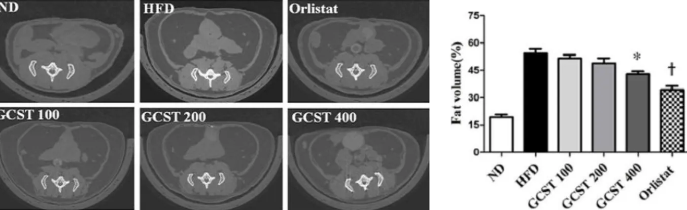 Fig.  6.  Effect  of  GCST  on  hepatic  lipid  accumulation  in  high  fat  diet-  fed mice using H&amp;E staining (×100).