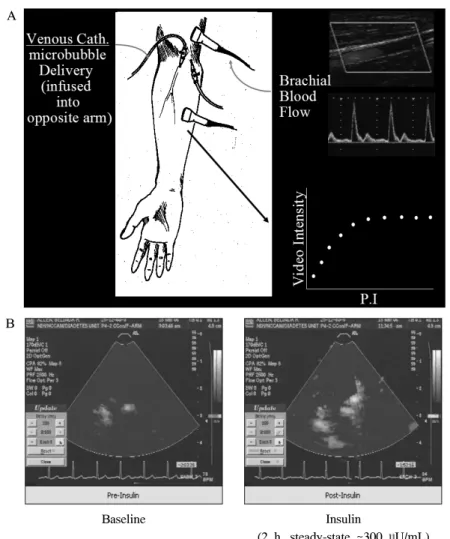 Fig.  2.  Brachial  artery  measurements  and  insulin-stimulated  capillary  recruitment  measured  by  contrast  enhanced  ultrasonography