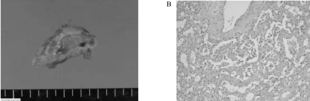 Fig.  3.  The  mass  was  composed  of  various  sized  blood  vessels  (H&amp;E,  orig