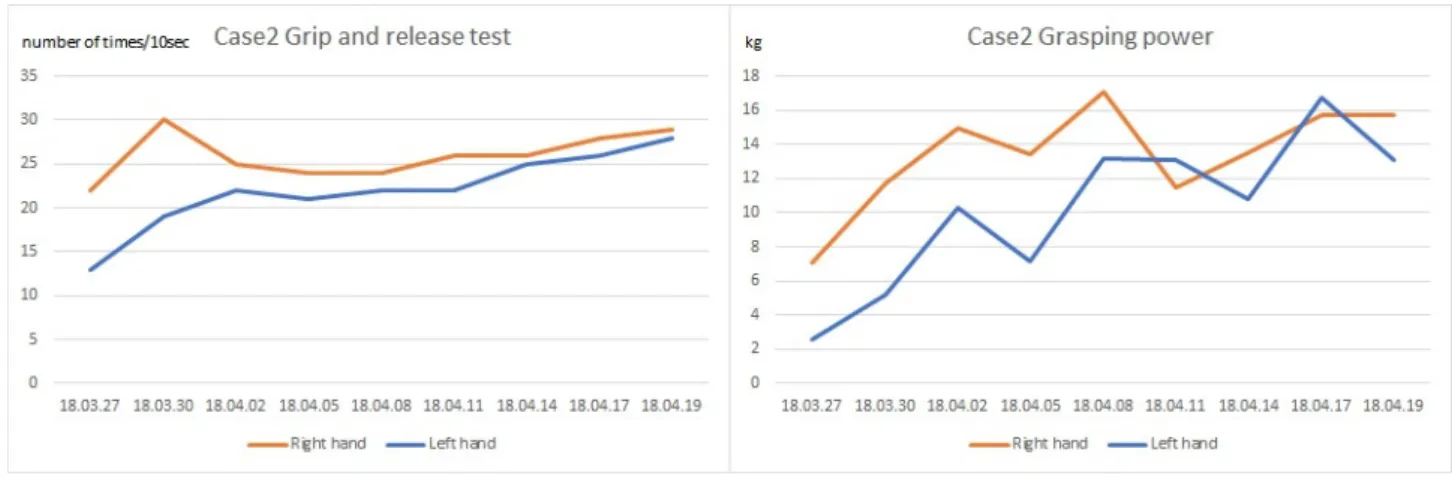 Fig. 4. Change of grip and release test, grasping power of case 2. 악력 또한 양측이 비슷해졌으며 퇴원 시까지 컨디션에  따라 조금씩 변동은 있었지만 입원 당시에 비해 매우  호전된 것을 알 수 있었다