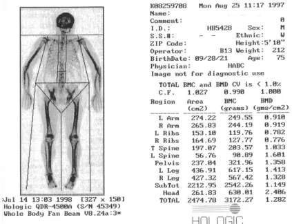Fig.  3.  Estimation  of  skeletal  muscle  mass  by  whole  body  scan  using  dual  energy  X-ray  absorptiometry  (DEXA)