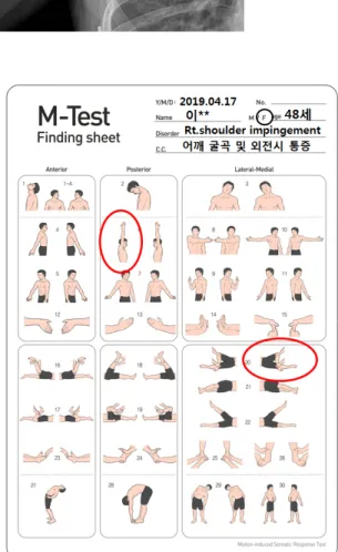 Fig. 9. Clinical finding of April 7, 2019.