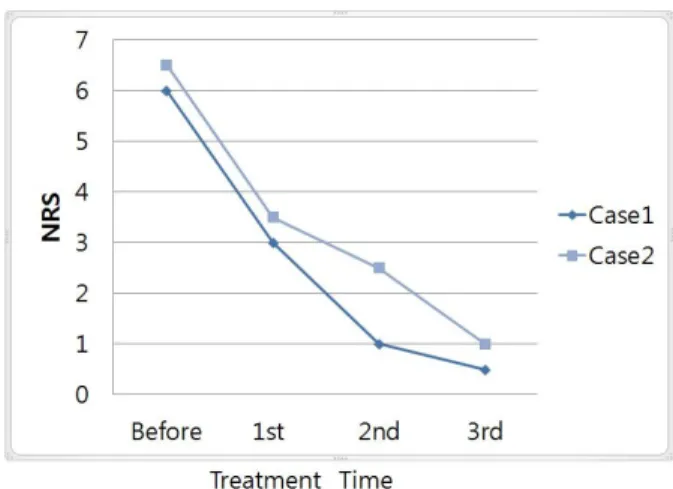 Table III. The Change of ROM before and after TreatmentFig. 14. Structure of tensegrity12).