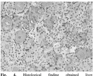Fig.  4.  Histological  finding  obtained  liver. 