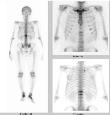 Table  1.  Laboratory  findings  of  the  patient