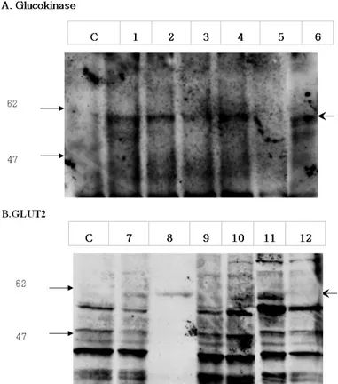 Fig.  3.  Western  blot  analysis  of  glucokinase  or  GLUT2  protein  in  C2C12-derived  cell  line  at  the  8 th   week  after  transfection