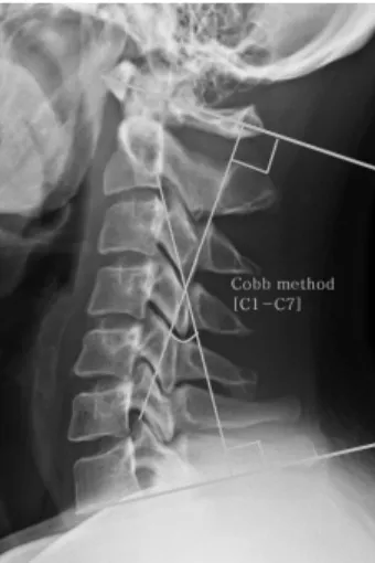 Fig.  3.  Cobb’s  angle  (C1-C7). 3)  경침  자가  운동  프로그램 1회  차  침  치료  이후  대상자는  네덜란드산  소나무로 제작한  반원통  모양의  경침(기황산업,  고양,  경기,  한국)을  제공하였다