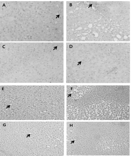 Fig.  8.  Histopathology  of  liver  tissue  with  Oil  Red  O  staining  (A∼D)  and  Hematoxyline  and  Eosin  (E∼H)