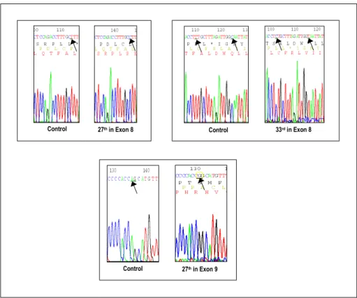 Fig.  1.  Analyses  of  gene  mutations  in  patients  with  fibrous  dysplasia.  The  figures  show  the  intron  sequences  of  the  GNAS1  gene