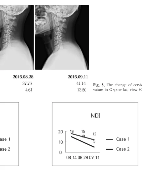 Fig.  5.  The  change  of  cervical  cur- cur-vature in C-spine lat.  view  (Case  2).