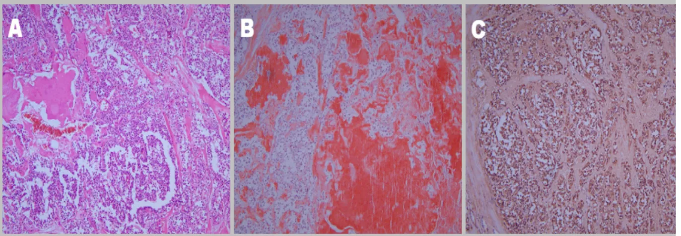 Table  1.  Distribution  of  RET  Proto-Oncogene  Mutations  in  Korean  MEN  Patients